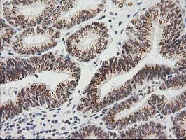 LOX Antibody in Immunohistochemistry (Paraffin) (IHC (P))