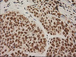 LOX Antibody in Immunohistochemistry (Paraffin) (IHC (P))