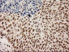 LOX Antibody in Immunohistochemistry (Paraffin) (IHC (P))