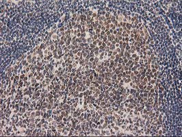 LOX Antibody in Immunohistochemistry (Paraffin) (IHC (P))