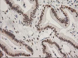 LOX Antibody in Immunohistochemistry (Paraffin) (IHC (P))