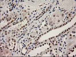 LOX Antibody in Immunohistochemistry (Paraffin) (IHC (P))