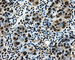 LOX Antibody in Immunohistochemistry (Paraffin) (IHC (P))