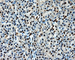 LOX Antibody in Immunohistochemistry (Paraffin) (IHC (P))