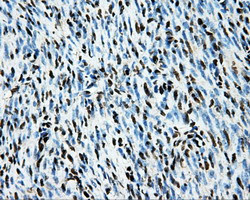 LOX Antibody in Immunohistochemistry (Paraffin) (IHC (P))