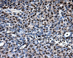 LOX Antibody in Immunohistochemistry (Paraffin) (IHC (P))