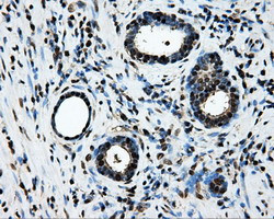 LOX Antibody in Immunohistochemistry (Paraffin) (IHC (P))