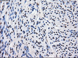 LOX Antibody in Immunohistochemistry (Paraffin) (IHC (P))