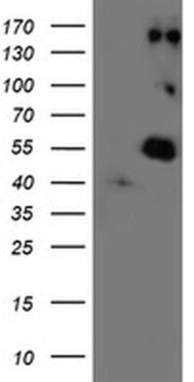 LOX Antibody in Western Blot (WB)