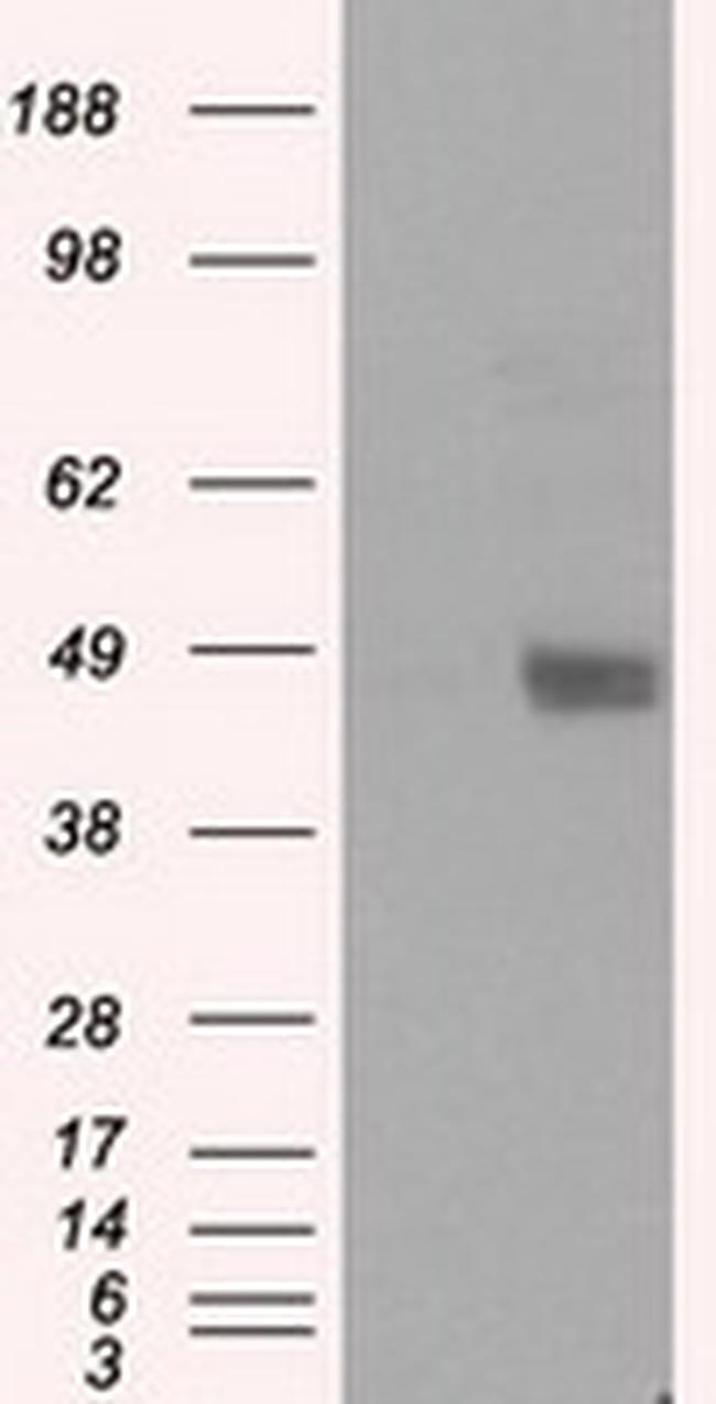 LOX Antibody in Western Blot (WB)