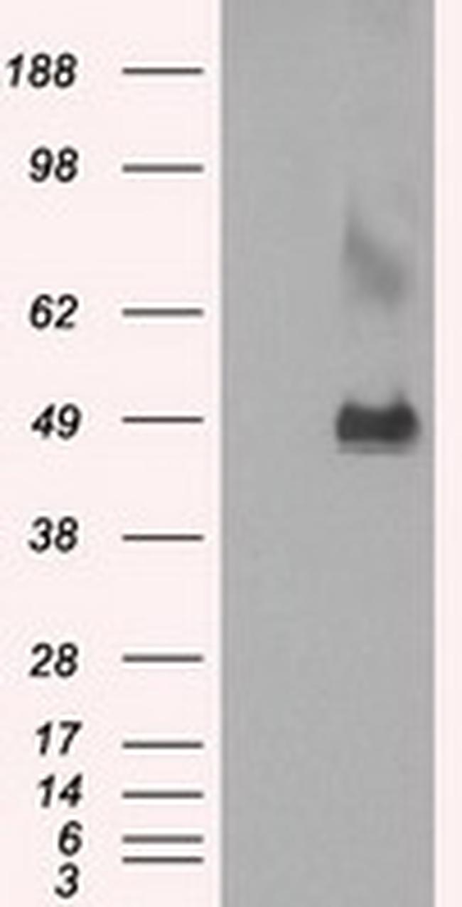 LOX Antibody in Western Blot (WB)