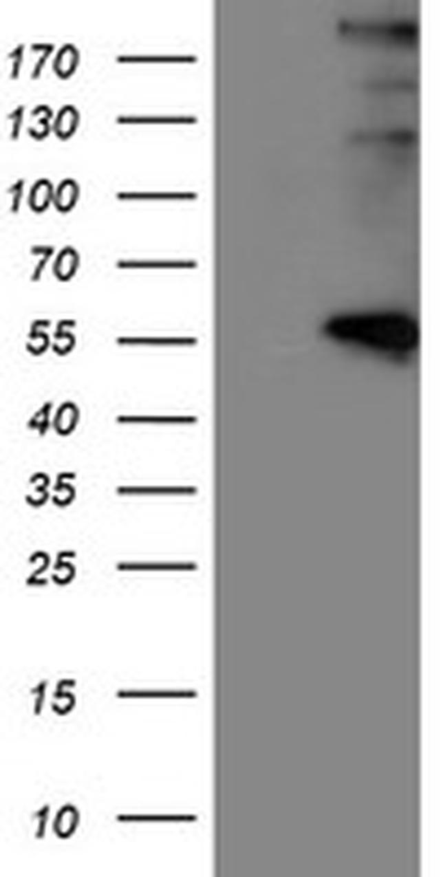 LOX Antibody in Western Blot (WB)