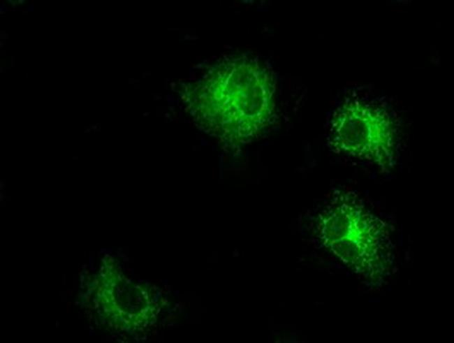 LOX Antibody in Western Blot (WB)