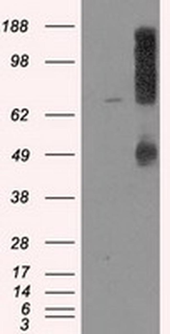 LOX Antibody in Western Blot (WB)