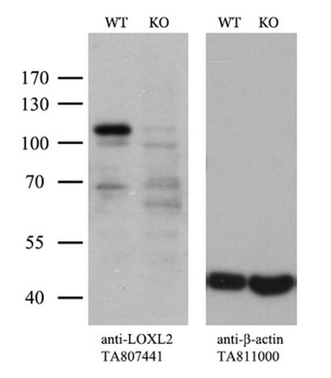 LOXL2 Antibody in Western Blot (WB)