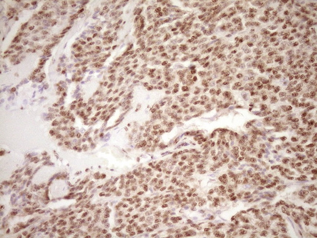 LPIN1 Antibody in Immunohistochemistry (Paraffin) (IHC (P))