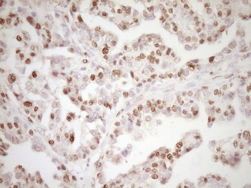 LPIN1 Antibody in Immunohistochemistry (Paraffin) (IHC (P))