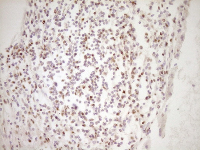 LPIN1 Antibody in Immunohistochemistry (Paraffin) (IHC (P))