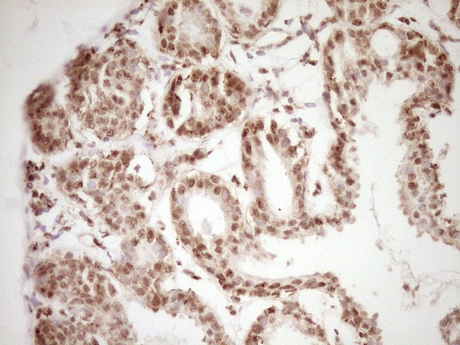 LPIN1 Antibody in Immunohistochemistry (Paraffin) (IHC (P))