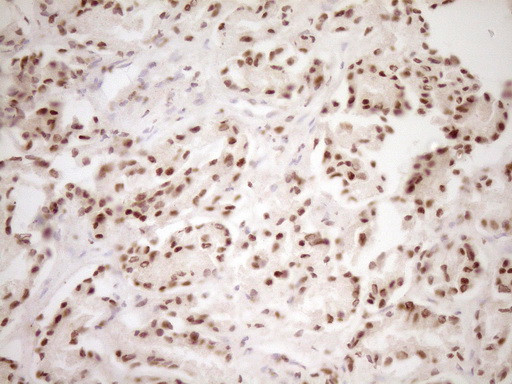 LPIN1 Antibody in Immunohistochemistry (Paraffin) (IHC (P))