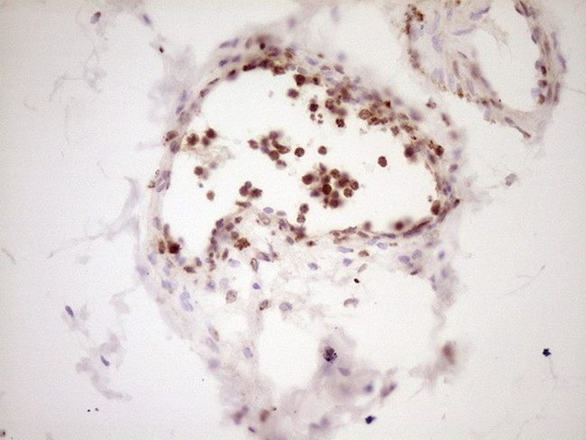 LPIN1 Antibody in Immunohistochemistry (Paraffin) (IHC (P))