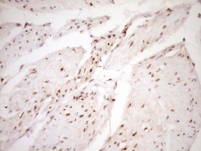 LPIN1 Antibody in Immunohistochemistry (Paraffin) (IHC (P))