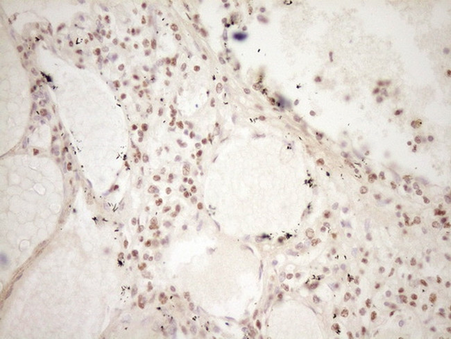 LPIN1 Antibody in Immunohistochemistry (Paraffin) (IHC (P))