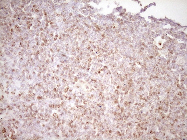 LPIN1 Antibody in Immunohistochemistry (Paraffin) (IHC (P))