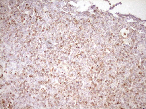 LPIN1 Antibody in Immunohistochemistry (Paraffin) (IHC (P))