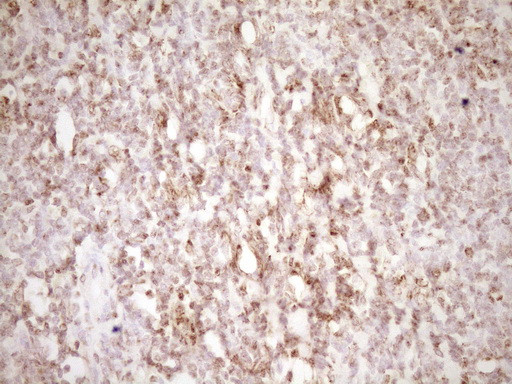 LPIN1 Antibody in Immunohistochemistry (Paraffin) (IHC (P))