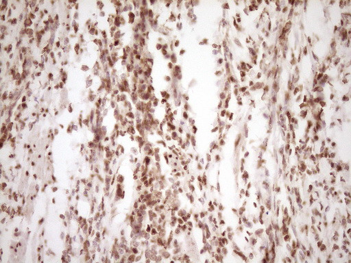 LPIN1 Antibody in Immunohistochemistry (Paraffin) (IHC (P))