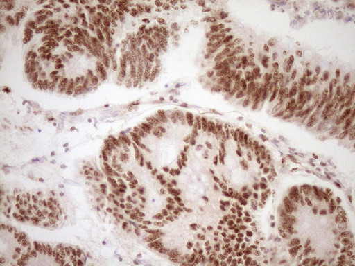 LPIN1 Antibody in Immunohistochemistry (Paraffin) (IHC (P))