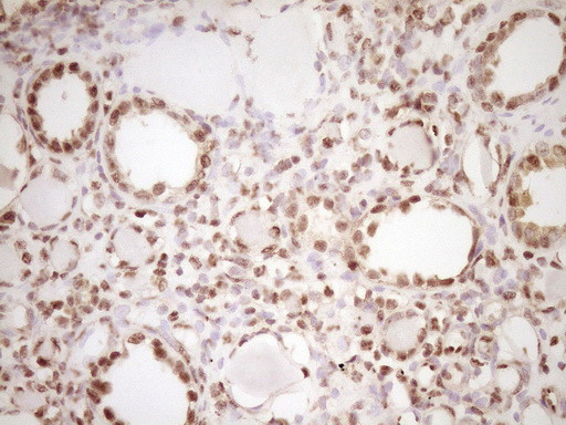 LPIN1 Antibody in Immunohistochemistry (Paraffin) (IHC (P))