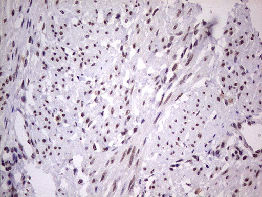 LPIN1 Antibody in Immunohistochemistry (Paraffin) (IHC (P))