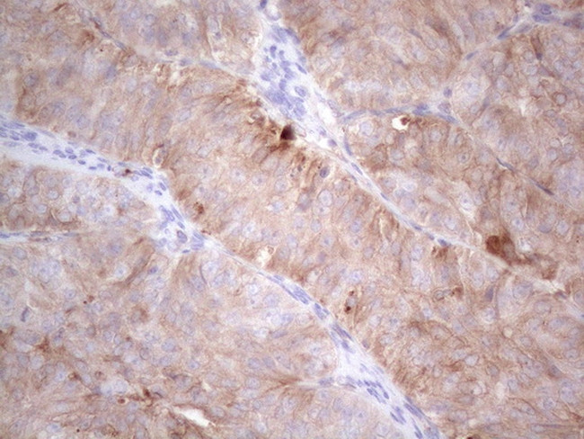 LPIN1 Antibody in Immunohistochemistry (Paraffin) (IHC (P))