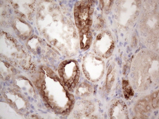 LPIN1 Antibody in Immunohistochemistry (Paraffin) (IHC (P))