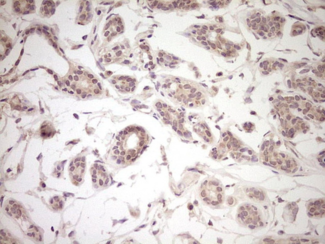 LPIN1 Antibody in Immunohistochemistry (Paraffin) (IHC (P))