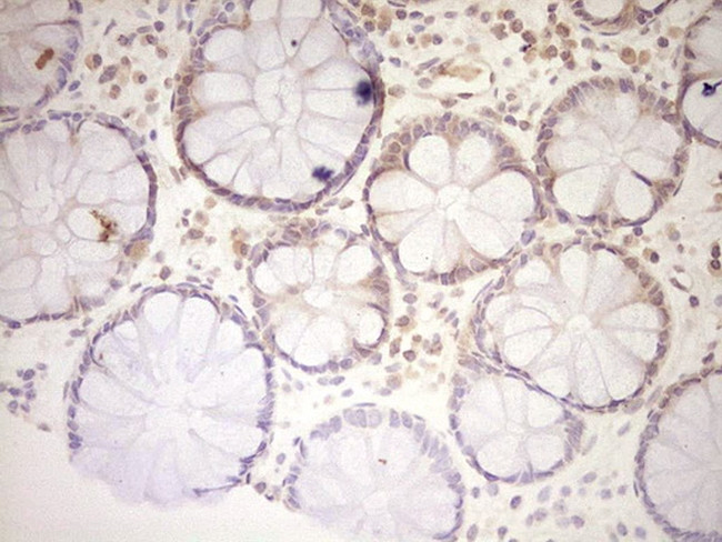 LPIN1 Antibody in Immunohistochemistry (Paraffin) (IHC (P))