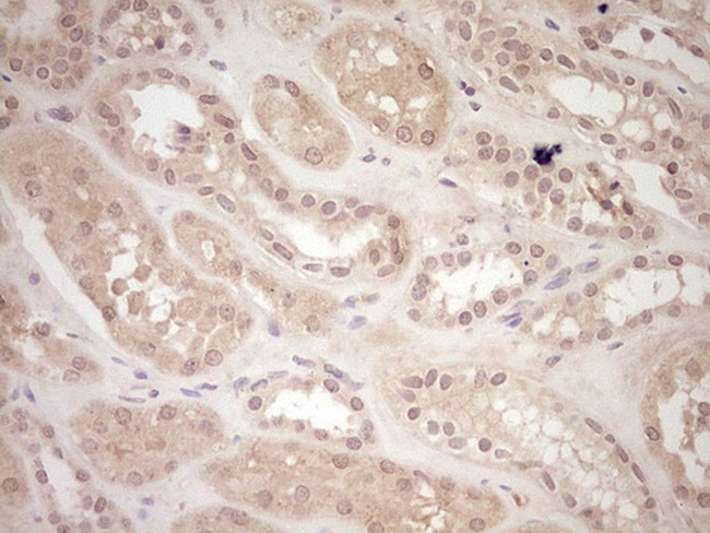 LPIN1 Antibody in Immunohistochemistry (Paraffin) (IHC (P))