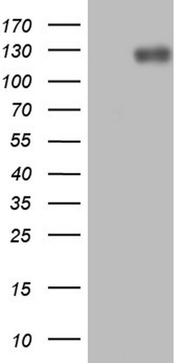 LPIN1 Antibody in Western Blot (WB)