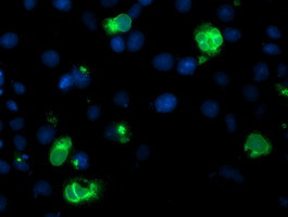 LPL Antibody in Immunocytochemistry (ICC/IF)