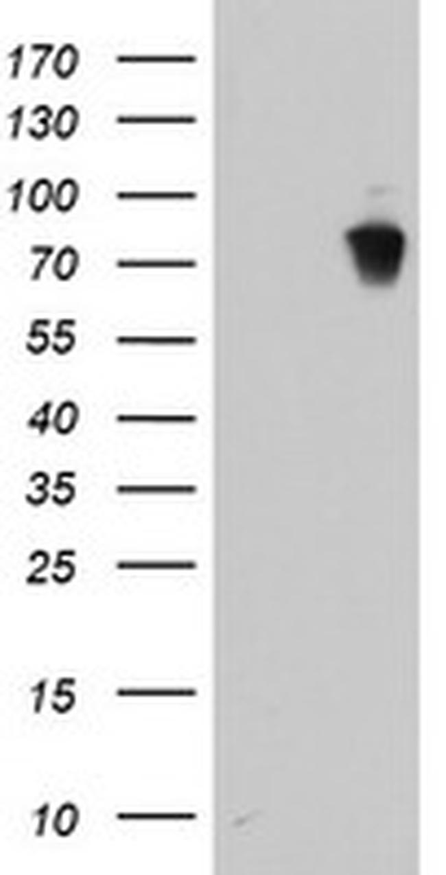 LRRC50 Antibody in Western Blot (WB)