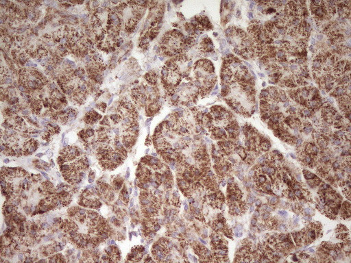 LRRC6 Antibody in Immunohistochemistry (Paraffin) (IHC (P))