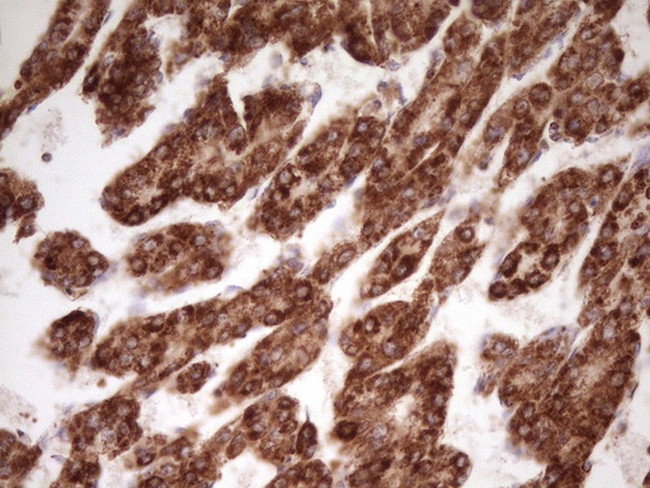 LRRC6 Antibody in Immunohistochemistry (Paraffin) (IHC (P))