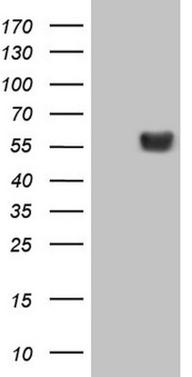 LRRC6 Antibody in Western Blot (WB)