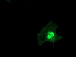 LSM1 Antibody in Immunocytochemistry (ICC/IF)