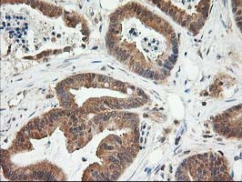 LSM1 Antibody in Immunohistochemistry (Paraffin) (IHC (P))