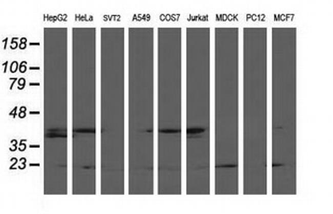 LSM1 Antibody in Western Blot (WB)