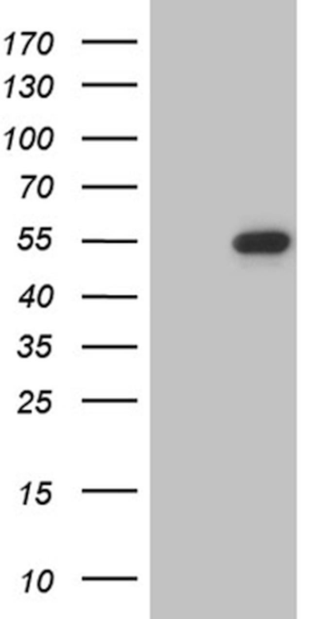 LSM11 Antibody in Western Blot (WB)