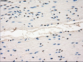 LTA4H Antibody in Immunohistochemistry (Paraffin) (IHC (P))